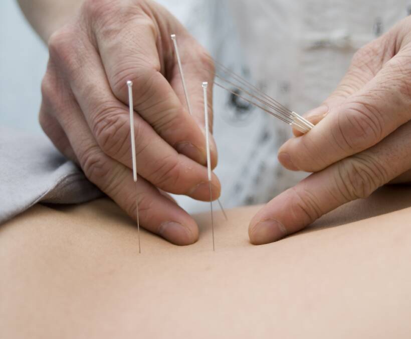 TRY AND SEE: With refunds available with most major health funds, acupuncture is an option available to assist in regaining your quality of life. 