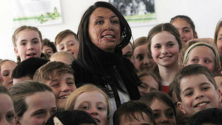 Turia Pitt as an inspiration speaker with students at Gwynneville. Photo: Andy Zakeli 