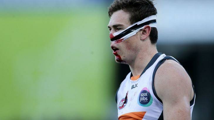Does this mean that Zac Dawson actually hit a target? Photo: Will Russell/AFL Media