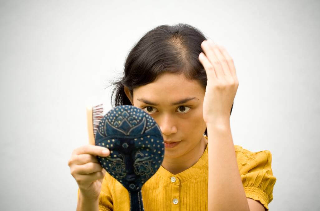 Hair loss affects women too, with about 30 to 40 per cent experiencing balding by the time they reach menopause. Picture: Shutterstock.